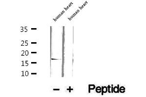 Western blot analysis of extracts of human heart tissue, using GMFG antibody. (GMFG antibody  (Internal Region))