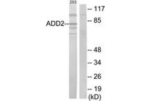 Western blot analysis of extracts from 293 cells, using ADD2 Antibody. (ADD2 antibody  (AA 471-520))