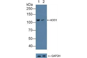 Western Blotting (WB) image for anti-Adducin 1 (Alpha) (ADD1) (AA 388-560) antibody (ABIN7444757)