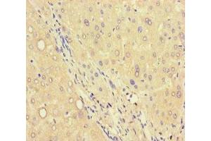 Immunohistochemistry of paraffin-embedded human liver tissue using ABIN7174872 at dilution of 1:100 (C6orf223 antibody  (AA 9-89))
