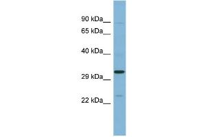 WB Suggested Anti-SET Antibody Titration: 0. (SET/TAF-I antibody  (N-Term))