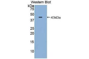 WB of Protein Standard: different control antibodies against Highly purified E.