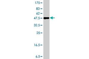 Western Blot detection against Immunogen (37 KDa) . (Formin 2 antibody  (AA 144-243))