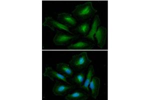 ICC/IF analysis of GLUL in HeLa cells. (GLN1 antibody  (AA 1-373))