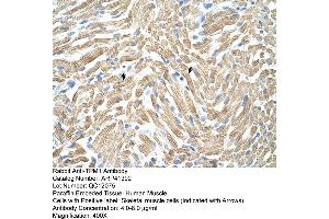 Rabbit Anti-TPM1 Antibody  Paraffin Embedded Tissue: Human Muscle Cellular Data: Skeletal muscle cells Antibody Concentration: 4. (Tropomyosin antibody  (N-Term))