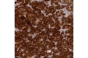 Immunohistochemical staining of human pancreas with PPP1R3F polyclonal antibody  shows strong cytoplasmic positivity in exocrine glands.