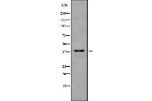 Western blot analysis of MARCH9 using MCF7 whole cell lysates (MARCH9 antibody  (N-Term))