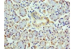 Immunohistochemistry of paraffin-embedded human pancreatic tissue using ABIN7148496 at dilution of 1:100 (COPS4 antibody  (AA 1-310))