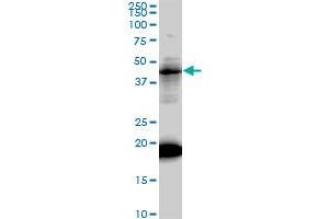 LEF1 monoclonal antibody (M01), clone 3H5. (LEF1 antibody  (AA 1-399))
