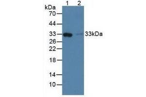 Western blot analysis of (1) Human Liver Tissue and (2) Human Lung Tissue. (FCN1 antibody  (AA 45-249))