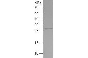 Western Blotting (WB) image for Collagen, Type IV, alpha 3 (Goodpasture Antigen) Binding Protein (COL4A3BP) (AA 347-598) protein (His tag) (ABIN7289568) (COL4A3BP Protein (AA 347-598) (His tag))