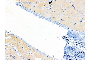 ABIN6258031 and ABIN6274975 at 1/100 staining Rat skin tissue by IHC-P.