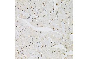 Immunohistochemistry of paraffin-embedded mouse heart using FOSL1 antibody (ABIN5973108) at dilution of 1/100 (40x lens). (FOSL1 antibody)