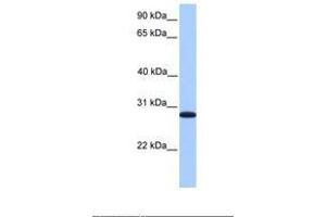 Image no. 1 for anti-Cyclin-Dependent Kinase Inhibitor 3 (CDKN3) (AA 51-100) antibody (ABIN6738871) (CDKN3 antibody  (AA 51-100))