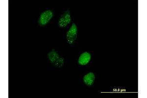 Immunofluorescence of purified MaxPab antibody to EAF1 on HeLa cell. (EAF1 antibody  (AA 1-268))