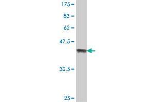 Western Blot detection against Immunogen (38. (MMP13 antibody  (AA 362-471))