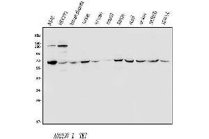 Western blot analysis of Transketolase/TKT using anti-Transketolase/TKT antibody (ABIN7598959). (TKT antibody  (AA 1-116))