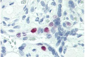 Human Placenta (formalin-fixed, paraffin-embedded) stained with SKP2 antibody ABIN337213 at 5 ug/ml followed by biotinylated anti-mouse IgG secondary antibody ABIN481714, alkaline phosphatase-streptavidin and chromogen. (SKP2 antibody)