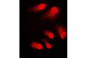 Immunofluorescent analysis of CBP staining in A431 cells. (CBP antibody  (C-Term))