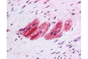 Immunohistochemistry (IHC) image for anti-Selenoprotein N, 1 (SEPN1) (C-Term) antibody (ABIN2783071) (SEPN1 antibody  (C-Term))