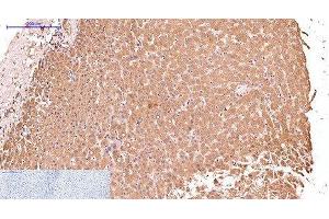 Immunohistochemistry of paraffin-embedded Human liver tissue using CK-17 Monoclonal Antibody at dilution of 1:200. (KRT17 antibody)