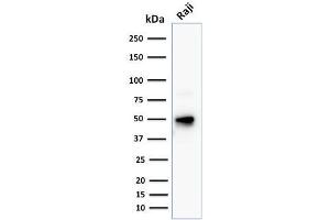 Western Blot Analysis of human Raji cell lysate using CD79a Mouse Monoclonal Antibody (JCB117 + HM47/A9). (CD79a antibody  (AA 202-216))