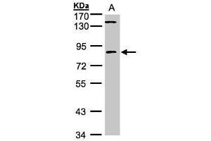 WB Image Sample (30μg whole cell lysate) A:293T 7. (LIMK2 antibody)