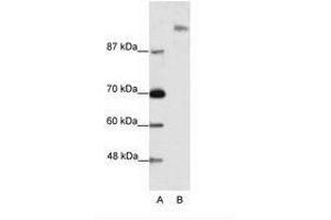 Image no. 1 for anti-Suppressor of Ty 6 Homolog (SUPT6H) (N-Term) antibody (ABIN202988) (Spt6 antibody  (N-Term))