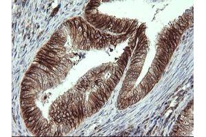 Immunohistochemistry (IHC) image for anti-ALX Homeobox 4 (ALX4) antibody (ABIN1496621) (ALX4 antibody)