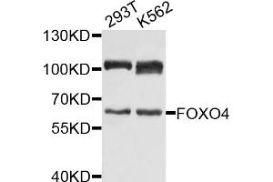 Western blot analysis of extracts of various cell lines, using FOXO4 antibody (ABIN1872735) at 1:1000 dilution. (FOXO4 antibody)