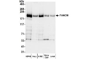 Western Blotting (WB) image for anti-Fanconi Anemia Complementation Group M (FANCM) (AA 1-50) antibody (ABIN7452758)