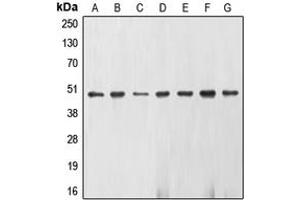 Western blot analysis of Gamma-enolase expression in U937 (A), K562 (B), Jurkat (C), NIH3T3 (D), KNRK (E), HepG2 (F), HeLa (G) whole cell lysates. (ENO2/NSE antibody  (C-Term))