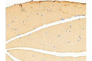 ABIN6259745 and ABIN6268879 at 1/100 staining Rat muscle tissue by IHC-P.