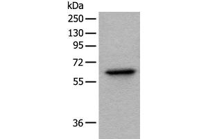 Western blot analysis of Hela cell lysate using BAIAP2L1 Polyclonal Antibody at dilution of 1:1000 (BAIAP2L1 antibody)