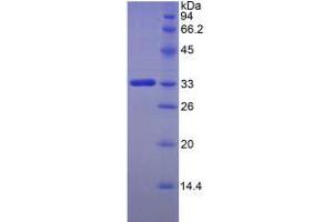 SDS-PAGE analysis of Human FKBP10 Protein.