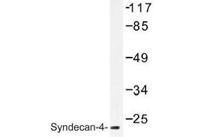 Image no. 1 for anti-Syndecan 4 (SDC4) antibody (ABIN317791) (SDC4 antibody)