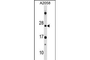 DRAP1 antibody  (N-Term)