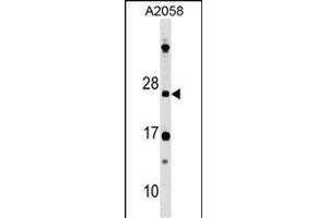 DR Antibody (N-term) 8211a western blot analysis in  cell line lysates (35 μg/lane). (DRAP1 antibody  (N-Term))