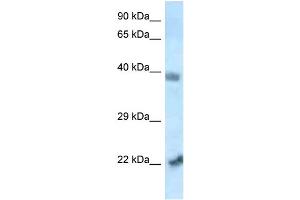 WB Suggested Anti-Vps72 Antibody   Titration: 1. (VPS72 antibody  (N-Term))