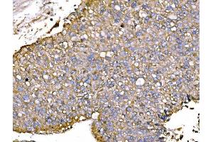 IHC analysis of P2X7/P2RX7 using anti-P2X7/P2RX7 antibody (ABIN7601815).