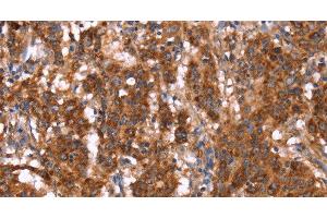 G Antigen 12I antibody