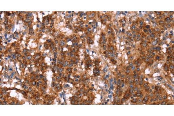 G Antigen 12I antibody