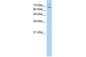 TSHR antibody used at 1 ug/ml to detect target protein. (TSH receptor antibody  (N-Term))