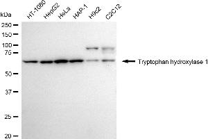 Western blotting analysis using tryptophan hydroxylase 1 antibody (ABIN7800653).