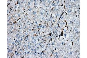 Immunohistochemical staining of paraffin-embedded liver tissue using anti-PSMC3mouse monoclonal antibody. (PSMC3 antibody)