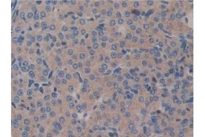 Detection of GAB3 in Mouse Ovary Tissue using Polyclonal Antibody to GRB2 Associated Binding Protein 3 (GAB3) (GAB3 antibody  (AA 142-375))