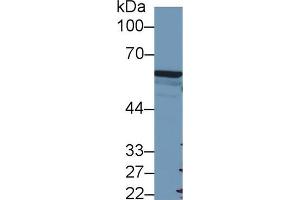 Western blot analysis of Human A549 cell lysate, using Mouse FOXP3 Antibody (2 µg/ml) and HRP-conjugated Goat Anti-Rabbit antibody ( (FOXP3 antibody  (AA 190-412))