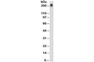 Western blot testing of Jurkat cell lysate with TAG-72 antibody (clone CC49).