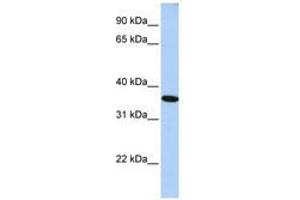 Image no. 1 for anti-General Transcription Factor IIA, 1, 19/37kDa (GTF2A1) (N-Term) antibody (ABIN6741429) (GTF2A1 antibody  (N-Term))