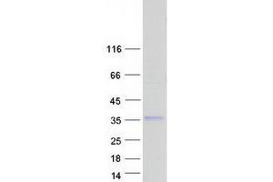 Lysosomal Protein Transmembrane 4 beta (LAPTM4B) protein (Myc-DYKDDDDK Tag)